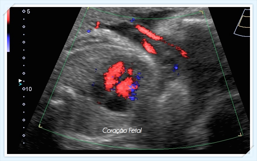 Coração Fetal