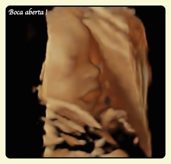 Boca Aberta