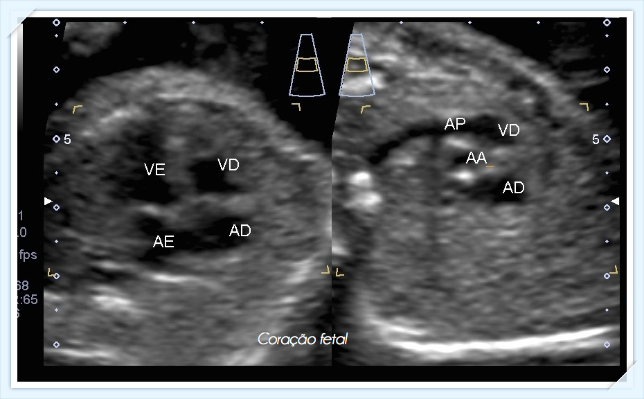 Coração Fetal